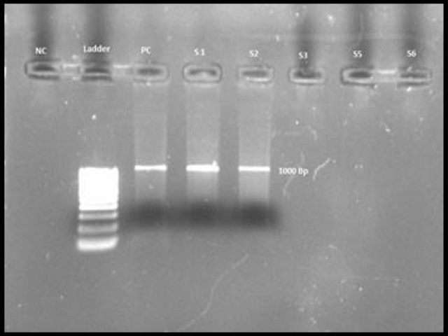 Evaluation of Nested broad-range PCR for Pathogen Detection in Negative Blood Cultures